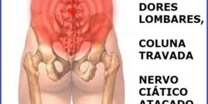 Vico Massagista, São José SC, Dor Nervo Ciático, Nas Costas, Coluna, Lombar, perna, coxa, panturilha - Massagem Terapêutica Quiropraxia Massoterapia Acupuntura