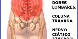 Vico Massagista, São José SC, Dor Nervo Ciático, Nas Costas, Coluna, Lombar, perna, coxa, panturilha - Massagem Terapêutica Quiropraxia Massoterapia Acupuntura
