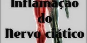 Nervo ciático inflamado - tratamento - Vico Massagista, São José SC, Quiropraxia, Massagem Terapêutica, Massoterapia e Acupuntura. Dor no piriforme