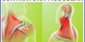 Contratura muscular - saiba como tratar e evitar contraturas musculares
