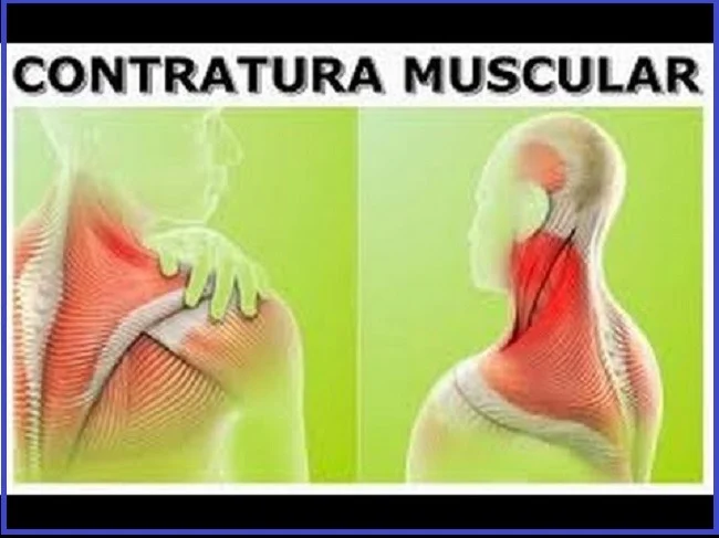 Contratura muscular - saiba como trata #massagem #massagista #massoterapia #dor #muscular #contratura #caimbra #lesao #distensao #contusao #machucado #nascostas #muscular #inflamacao #colunatravada #saojosesc #floripa #florianopolis #palhoca #biguacu #antoniocarlossc