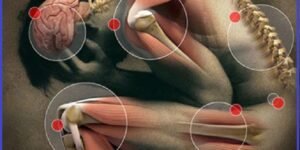 Contraturas e distensoes musculares - como definir e tratar essas dores