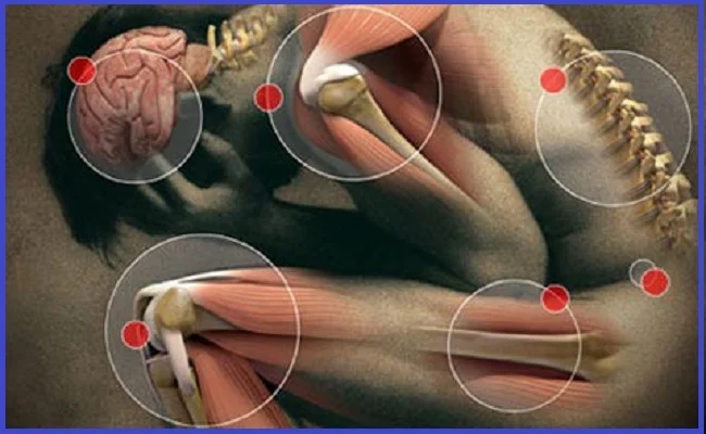 Contraturas e distensoes musculares - como definir e tratar essas dores. #massagem #massagista #massoterapia #dor #muscular #contratura #caimbra #lesao #distensao #contusao #machucado #nascostas #muscular #inflamacao #colunatravada #saojosesc #floripa #florianopolis #palhoca #biguacu #antoniocarlossc