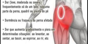 Nervo Ciático: conheça as principais causas das dores, inflamação, formigamento e travamento da coluna
