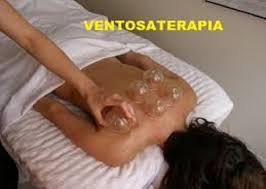 ventosaterapia
