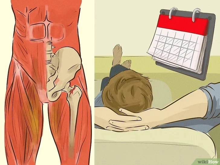 O que fazer para tratar e aliviar a dor causada por uma lesão na virilha. O que fazer para tratar e aliviar a dor causada por uma lesão na virilha.