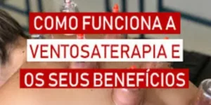 Ventosaterapia: como funciona a ventosaterapia e os seus benefícios e indicações.