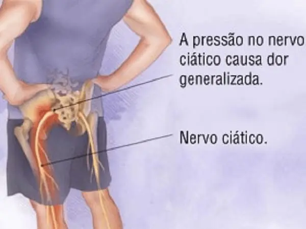 Massagem São José SC dor no ciático com Vico Massagista e Quiropraxia, que atende em São José (SC) e oferece: quiropraxia, massagem terapêutica, massoterapia e ventosas. Massagens e terapia para tratamento, alívio das dores e desconfortos em São José (SC). O melhor massagista d São José (SC) para nervo ciático.